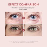 PDRN Eye Cream Manufacturer - OEM Pink Peptide Hyaluronic Acid Reduces Fine Lines Puffiness