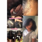 Lice Removal Shampoo Manufacturer - OEM Advanced Cleaning Relieving Itching Oil Control