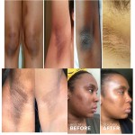 Inner Thigh Lightening Cream Manufacturer - OEM Private Label Dark Spots Eraser Bikini Whitening