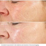 Glutathione Facial Serum Manufacturer - OEM Private Label with Niacinamide Vitamin C