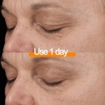 Anti Aging Serum Manufacturer - OEM Stock Wholesaler 1 Week Wrinkle Removal Fast Lines