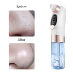 Electric Blackhead Remover - Vacuum Acne Treatment Supplier
