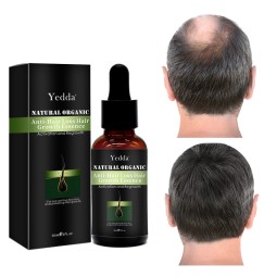 Hair Growth Essence - 100ml Vegan Herbal