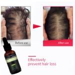 Hair Growth Oil - 30ml Professional Care