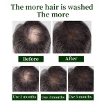 Hair Growth Spray - Natural Organic Private