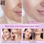 Neck Cream Manufacturer - Private Label Dual-Function Day Night Moisturizing Firming Anti-Wrinkle Repairing Tightening