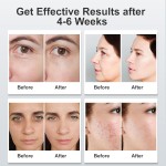 LED Light Therapy Mask Manufacturer - A10 Model 7 LED Photon for Facial Skin Care