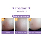 Stretch Mark Cream - 250ml Home Removal