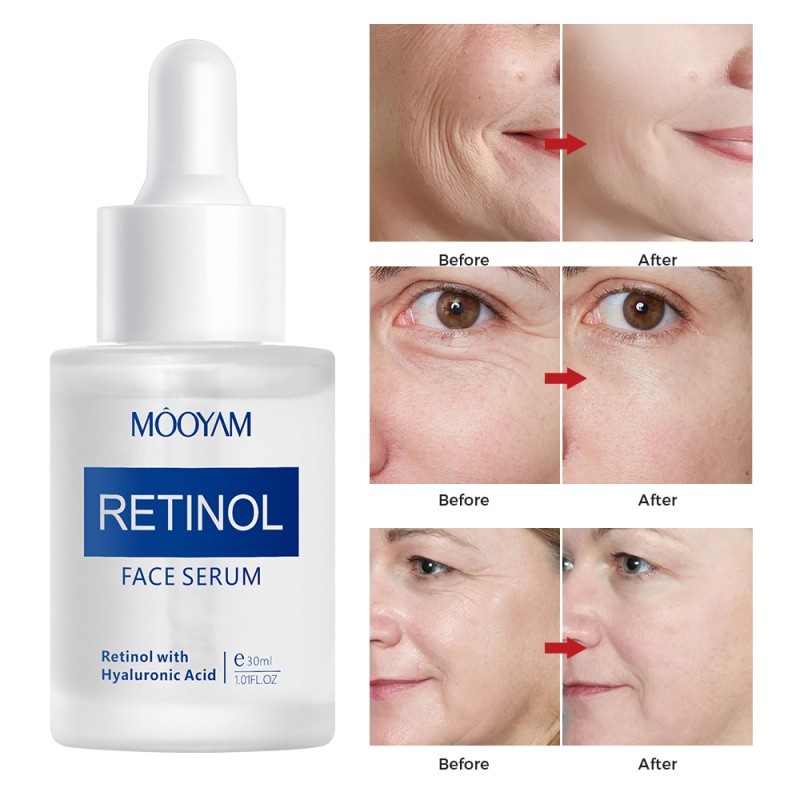 Private Label Retinol & Hyaluronic Acid Serum 30ml Anti-Wrinkle Smooth Fine Lines & Firm Skin MOOYAM Facial Serum
