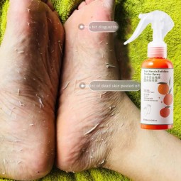 120ml足部去角质喷雾天然橙提取物清洁抗菌足部喷雾手死皮去角质喷雾