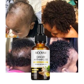 OEM Ginger Anti-hair Loss Essence Nourishing Serum Powerful Hair Moisturizing Formula Smooth 30ml MOOYAM Hair Care Growth Serum
