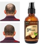 Hair Growth Spray Factory - Custom Logo Hair Loss Treatment Pure Growth Serum Spray