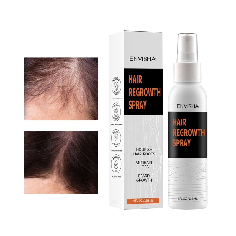 Hair Growth Spray Manufacturer - Factory Price Rapid Hair Thickening Growth Lotion Spray