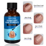 Nail Repair Serum Factory - Wholesale 30ml Fungal Nail Repair Serum Toenail Treatment Oil