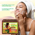 Face Wash Soap Factory - Organic African Black Soap Acne Scars Dark Spot Remover Soap