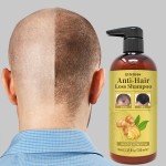 Hair Regrowth Shampoo Manufacturer - Eco Friendly Prevents Hair Loss Shampoo Conditioner