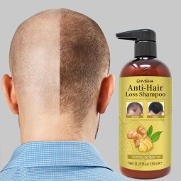 Hair Regrowth Shampoo Manufacturer - Eco Friendly Prevents Hair Loss Shampoo Conditioner