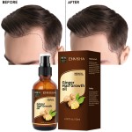 Hair Growth Spray Factory - Custom Logo Hair Loss Treatment Pure Growth Serum Spray