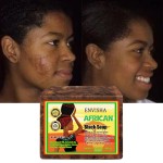 Face Wash Soap Factory - Organic African Black Soap Acne Scars Dark Spot Remover Soap