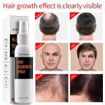Hair Growth Spray Manufacturer - Factory Price Rapid Hair Thickening Growth Lotion Spray