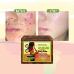 Face Wash Soap Factory - Organic African Black Soap Acne Scars Dark Spot Remover Soap