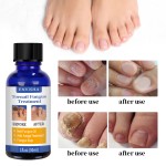 Nail Care Treatment Oil Manufacturer - Hot Sale Effectively Hand Feet Fungal Nail Repair Oil
