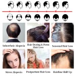 Hair Growth Oil Spray Factory - Private Label Organic Prevent Hair Loss Thicker Oil Spray