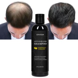 Hair Growth Shampoo Factory - Customized Korean Herbal Anti Loss Shampoo for Thinning Hair