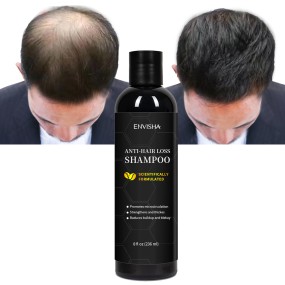 Hair Growth Shampoo Factory - Customized Korean Herbal Anti Loss Shampoo for Thinning Hair