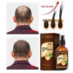 Hair Growth Spray Factory - Custom Logo Hair Loss Treatment Pure Growth Serum Spray
