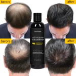 Hair Growth Shampoo Factory - Customized Korean Herbal Anti Loss Shampoo for Thinning Hair