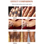 Dark Spots Corrector Cream Manufacturer - In Stock Body Bikini Face Acne Remove Anti Age Cream