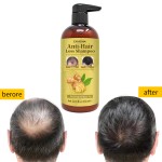 Hair Regrowth Shampoo Manufacturer - Eco Friendly Prevents Hair Loss Shampoo Conditioner