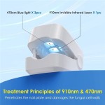Home Use Blue Light Toe Nail Laser Fungus Treatment Device Nail Fungus Cleaning Laser Device for Fingernails and Toenails