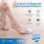 Nail Fungus Cleaning Laser Device 910nm 470nm Blue Light Therapy Nail Fungus Treatment for Toenail Fingernails Onychomycosis