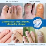 Home Use Blue Light Toe Nail Laser Fungus Treatment Device Nail Fungus Cleaning Laser Device for Fingernails and Toenails