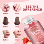 Priviate Label Biotin Hair Growth Gummies Collagen Keratin Gummy Factory Price  Vitamin Healthy Supplement