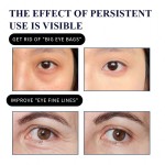 Oem热卖下玫瑰水晶胶原蛋白眼膜浮肿减少黑眼圈