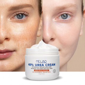 factory Oem Custom Anti Fungal Repair Foot Scrub Exfoliation Dead Skin Removal Peeling Moisturizing 40% Urea Hand Cream for Cracked Heels