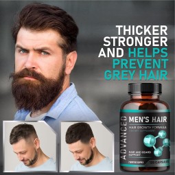 OEM Men's Hair Growth Supplement Biotin Capsules Natural Plant Extract Hair Beard Support Diet