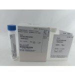 Biochemistry Reagent Manufacturer - HbA1c GLU CHO HDL-C LDL-C