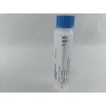 Free Fatty Acids Assay Kit Supplier - WEIYI Brand NEFA