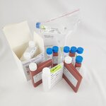 5'-Nucleotidase Test Kit Supplier - Liver Function Analyzer