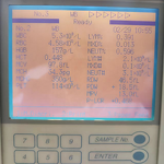 Hematology Analyzer Supplier - Refurbished Sysmex KX21 KX21N