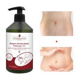 Stretch Mark Oil Supplier - Wholesale 500ml Plant-Based Skin Repair