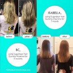 Hair Skin Nails Gummies Supplier - Biotin Vitamins Supplement