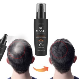 Anti Hair Loss Spray Manufacturer - Private Label Growth Serum Biotin