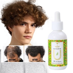 Hair Strengthening Oil Supplier - Rosemary Mint Dry Nourishing Treatment