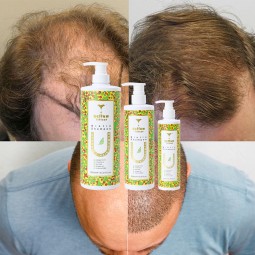 Anti Hair Loss Shampoo Manufacturer - OEM/ODM Ginger Biotin Collagen