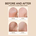 Facial Cleanser Manufacturer - Organic Gentle Cleansing Pore Removal Hydrating